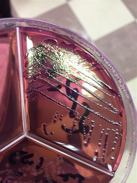 E Coli On Emb Agar