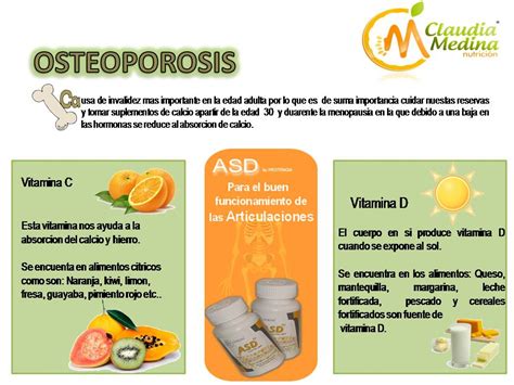 Claudia Medina NutriciÓn Osteoporosis