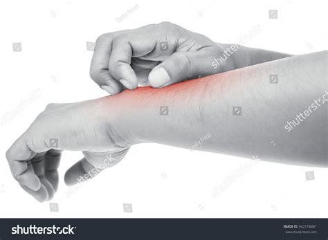 People Scratch Itch Hand Itching Concept Stock Photo 542118481