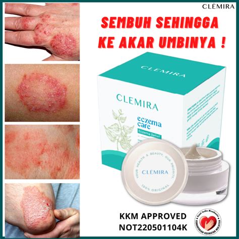 Clemira Eczema Cream Ubat Gatal Kulit Ubat Panau Ubat Kurap Ubat Gatal