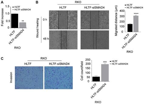 HLTF suppresses CRC cell migration and invasion via TGF β SMAD