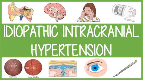 Idiopathic Intracranial Hypertension YouTube