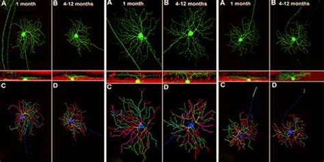 Retinal Ganglion Cells