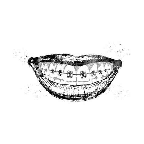 Teeth Braces By Erzebeth Teeth Art Dentist Art Teeth Drawing