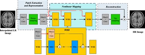 Figure 1 From MR Image Super Resolution Via Wide Residual Networks With