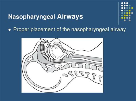 Ppt Airway Management Part I Powerpoint Presentation Free Download