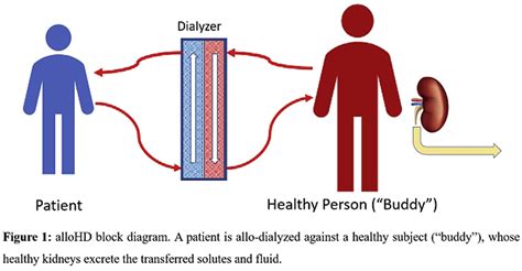 Sat 066 Allo Hemodialysis A Novel Extracorporeal Technique To Treat