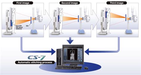 Aerodr Auto Stitching System Digital Radiography Konica Minolta