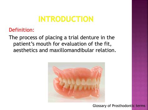 Ppt Try In Of Complete Dentures Powerpoint Presentation Free Download Id4997759