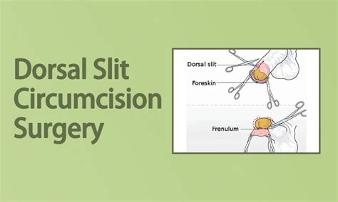 Paraphimosis Dorsal Slit