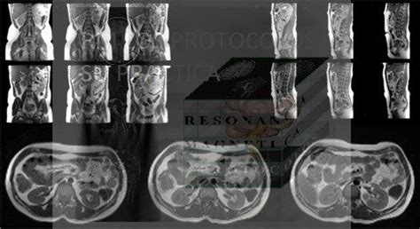 Ri Ones Resonancia Magn Tica Los Protocolos Y Su Pr Ctica