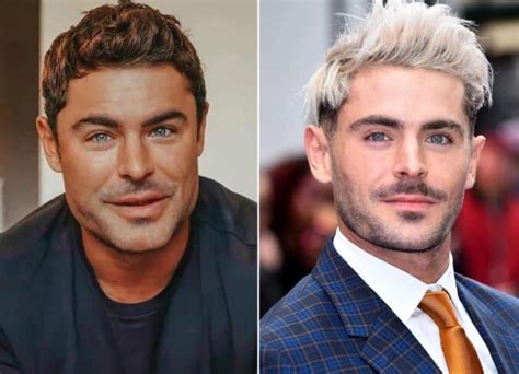 Zac Efrons Plastic Surgery His Explanation For Why His Appearance Has