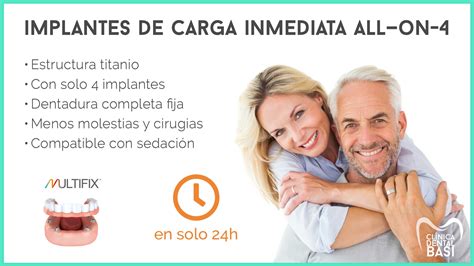 Implantes De Carga Inmediata Cl Nica Dental Basi