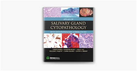 Atlas of Salivary Gland Cytopathology على Apple Books