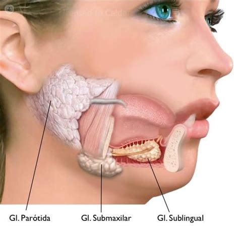 Tumores En Las Gl Ndulas Salivales