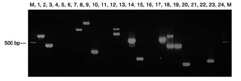 LM PCR Analysis Of Transposon Insertions The Agarose Gel Shows