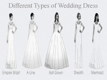 Share 78 Types Of Frocks With Names Best 3tdesign Edu Vn