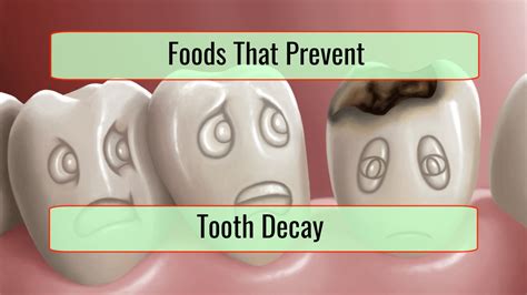 4 Foods That Prevent Tooth Decay And 8 Foods That Damage Your Teeth