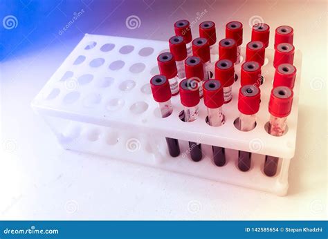 Tubos Da Amostra De Sangue Para Testes De Laborat Rio Foto De Stock