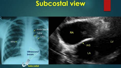 Basic Echocardiographic Views