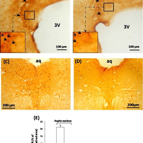 Light Micrographs Of Frontal Sections Throughout The Subcommissural