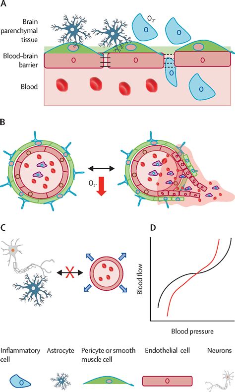 Cerebral Microvascular Complications Of Type Diabetes Stroke