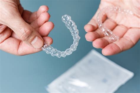 Can Invisalign Fix An Overbite 207dentalcare