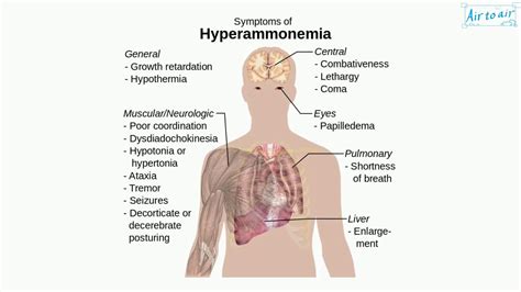 hyperammonemia - YouTube