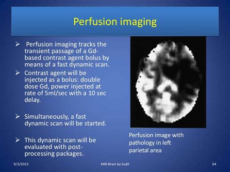 Mri Procedure Of Brain