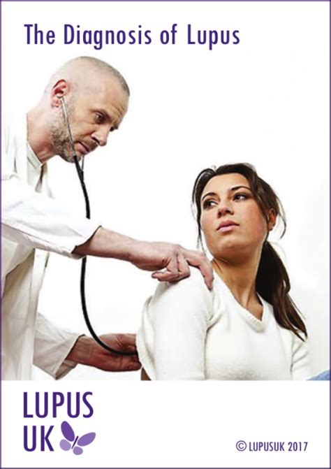 lupus-diagnosis | Arthritis and Musculoskeletal Alliance