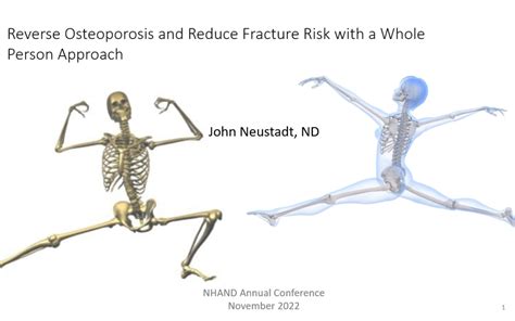 Reverse Osteoporosis And Reduce Fracture Risk With A Whole Person Approach Dr John Neustadt