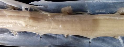 Term: Denticulate ligament - NeuroPetVet