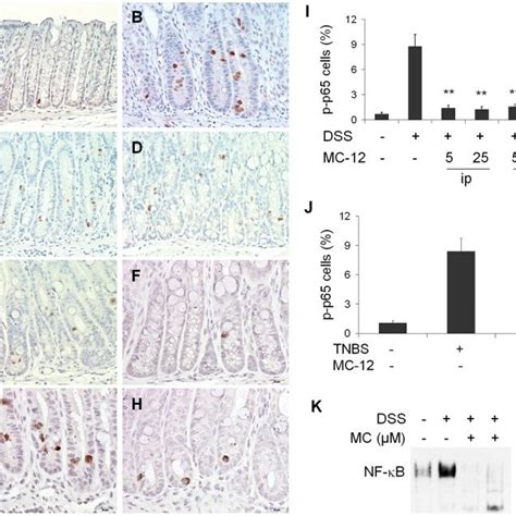 Representative Photomicrographs Of Tissue Sections With COX 2