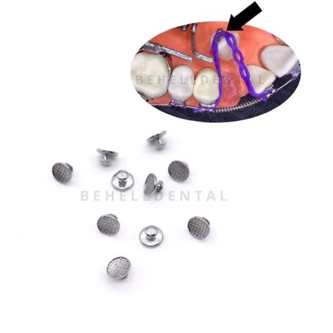 Jual ORIGINAL LINGUAL BUTTON ISI 10 Round Bulat Bundar Bondable