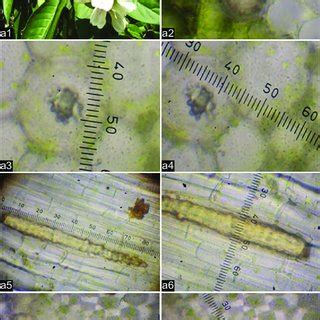 (PDF) Morphological, structural and micrometric study of cystolith of ...