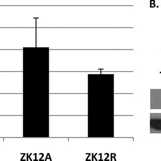 Sumoylation Does Not Alter Z Subcellular Localization HeLa Cells Were