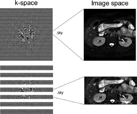 Aliasing And Undersampling Of K Space Top Row Aliasing Or Wraparound