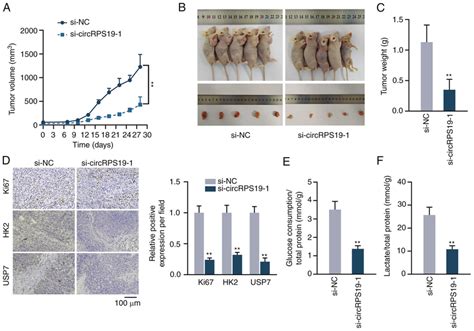 Circrps Promotes Gc Cell Proliferation And Aerobic Glycolysis In