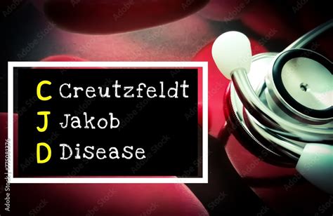 Foto De Creutzfeldt Jakob Disease Cjd Is A Rare Rapidly Worsening