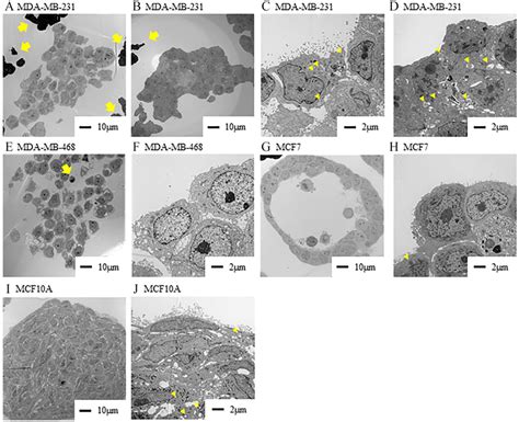 Comparison Of Lipid Droplets In The Clusters All Cell Line Clusters