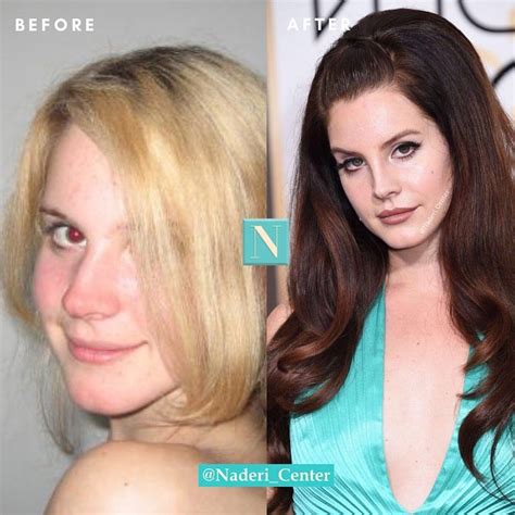 From Lizzy Grant To Lana Del Rey What Do You Think Of Lanas