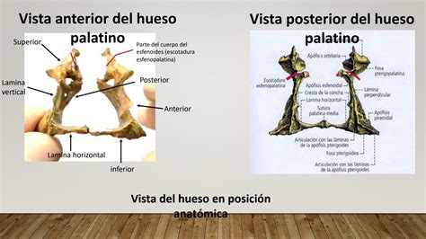 SOLUTION: Hueso palatino anatomia - Studypool