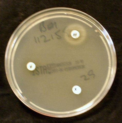 Haemophilus influenzae requires X and V factors for growth. In this ...