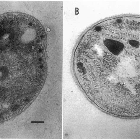 Electron Micrographs Of WT A And G7 Mutant B Cells Of Synechocystis