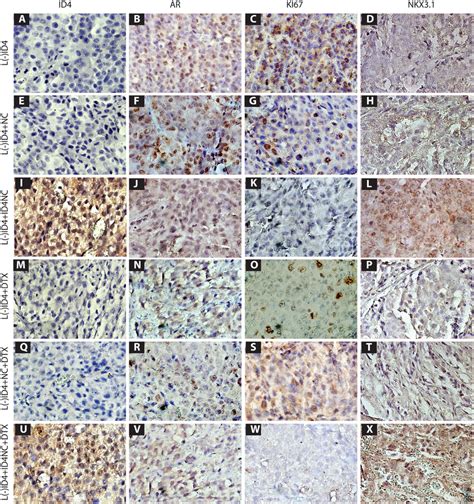 Immuno Histochemical Localization Brown Staining Of ID4 AR Ki67 And