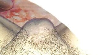 Penectomy Total Free Gay BDSM HD Porn Video F XHamster XHamster