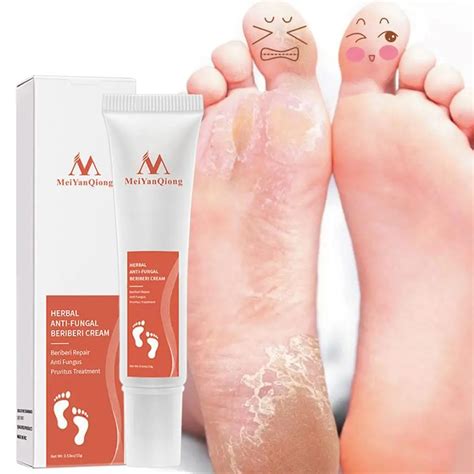 Anti Crack Foot Cream Feet Peel Mask Heel Cracked Dry Heel Cracked