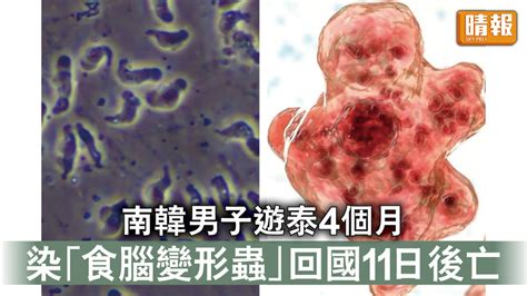 食腦變形蟲｜南韓男子遊泰4個月 染「食腦變形蟲」回國11日後亡 晴報 時事 要聞 D221227