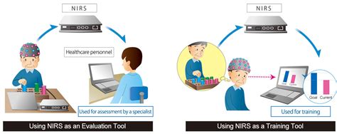 Nirs Neurorehabilitation Research Development Shimadzu Corporation