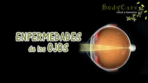 Enfermedades De Los Ojos ~ Salud Y Bienestar